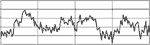 Electrocardiog. Cahos cardiaque